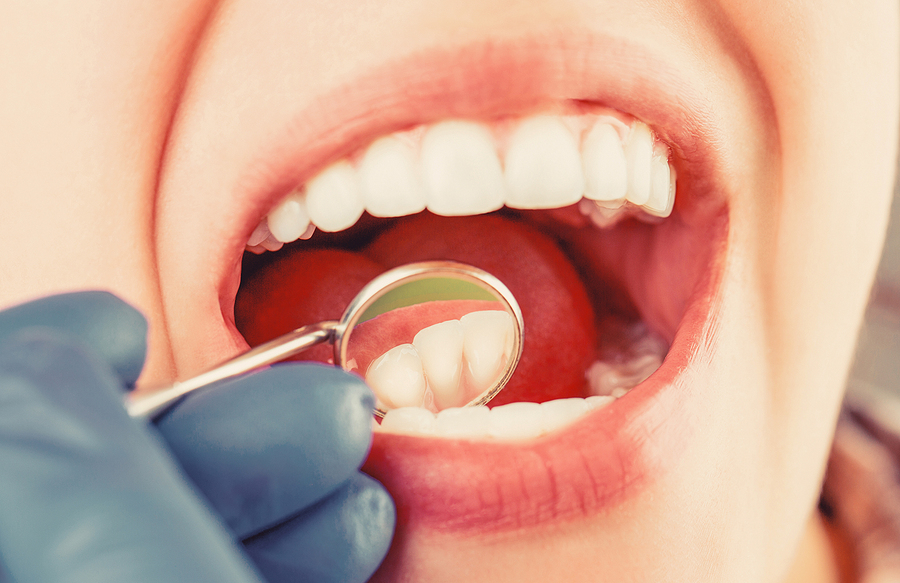 Facts on Endodontic Therapy
