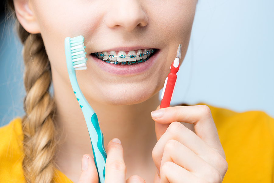 An Orthodontic Solution for Any Situation